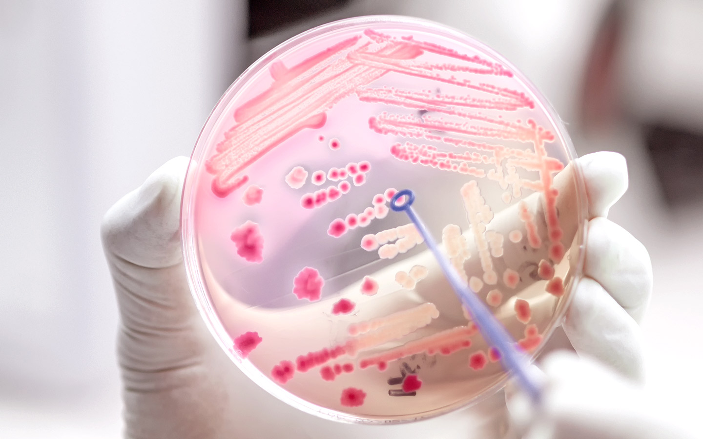 Foto: Eine Petrischale mit Bakterien.