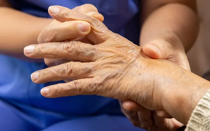 Eine Pflegekraft untersucht die Hand einer älteren Person – Fokus auf geschwollene Finger und Gelenke, möglicherweise durch rheumatoide Arthritis verursacht.