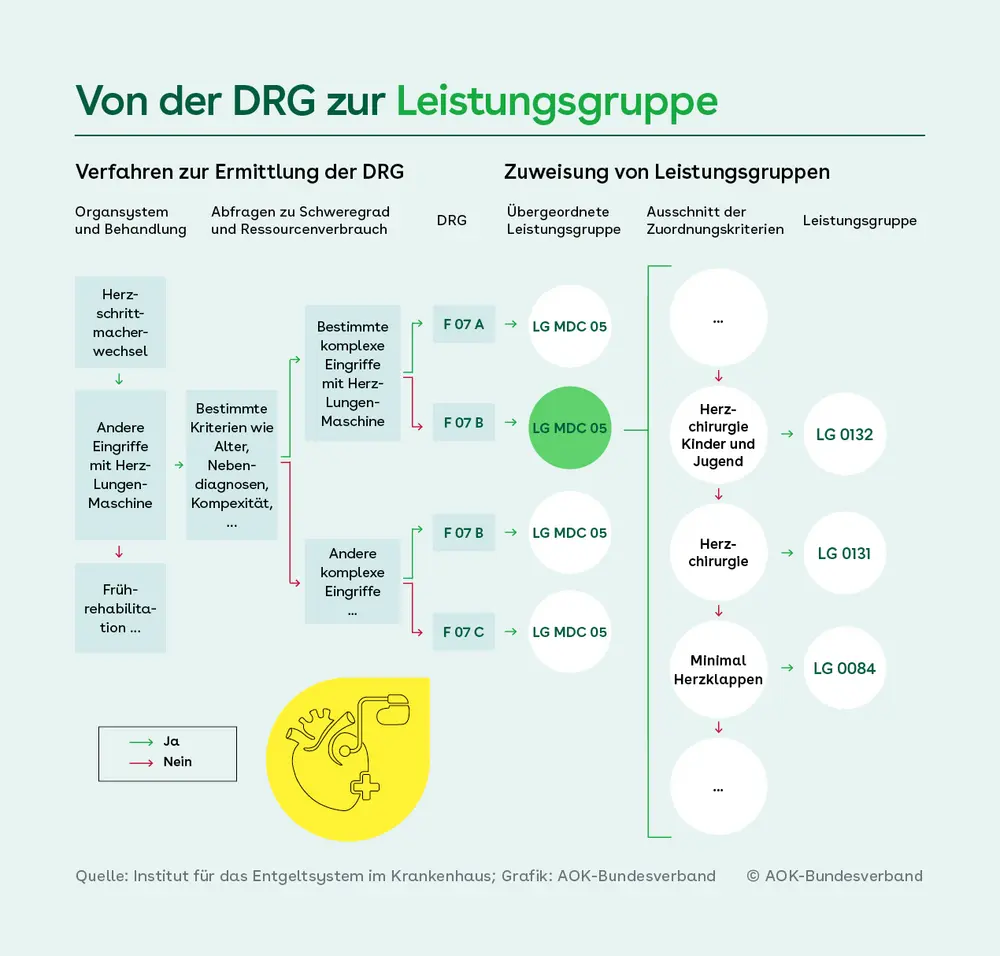 Die Infografik zeigt den Weg von medizinischen Behandlungen zur DRG und anschließend zur Leistungsgruppe. Beispiel: Der "Herzschrittmacherwechsel" führt über Kriterien wie "Eingriffe mit Herz-Lungen-Maschine" und weitere – je nach Schweregrad –zu den DRGs F07A bis F07C. Diese werden der übergeordneten Leistungsgruppe MDC 05 zugeordnet. Daraus erfolgt eine weitere Zuweisung zu konkreten Leistungsgruppen, z. B. zur LG 0132 über Zuweisungskriterien wie "Herzchirurgie Kinder und Jugend" oder andere, oder zur LG 0084 über das Zuweisungskriterium "Minimalinvasive Herzklappeneingriffe". Quelle: InEK, AOK-Bundesverband.
