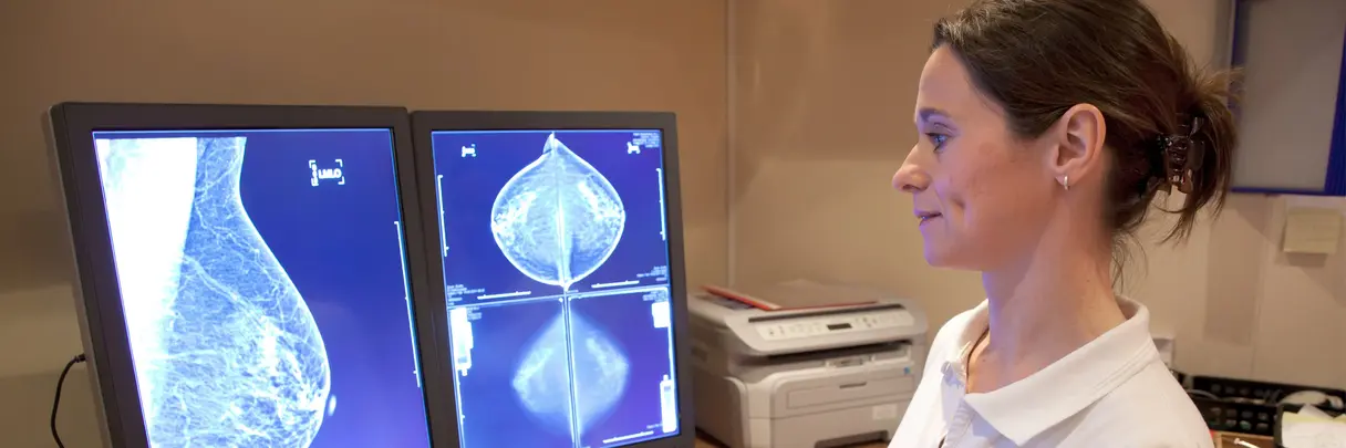 Ärztin analysiert Mammografie-Aufnahmen am Computer.