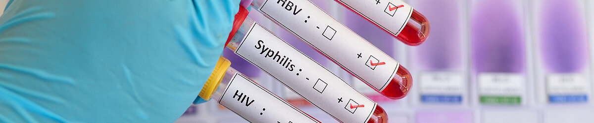 Aufklarung Und Beratung Zu Sexuell Ubertragbaren Krankheiten Aok Gesundheitspartner