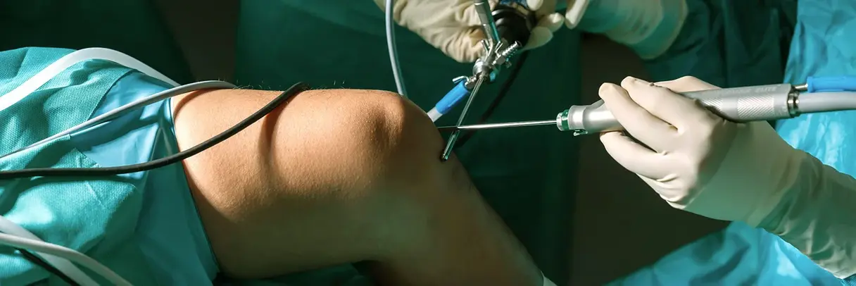 Das Bild zeigt ein Knie während einer Knie-OP im Krankenhaus.