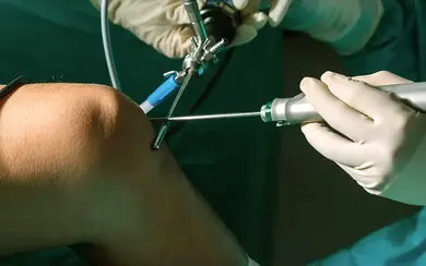 Das Bild zeigt ein Knie während einer Knie-OP im Krankenhaus.