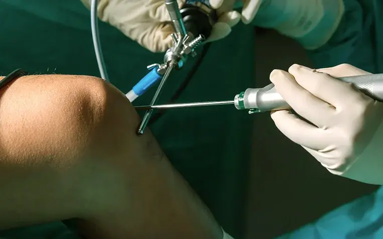 Das Bild zeigt ein Knie während einer Knie-OP im Krankenhaus.