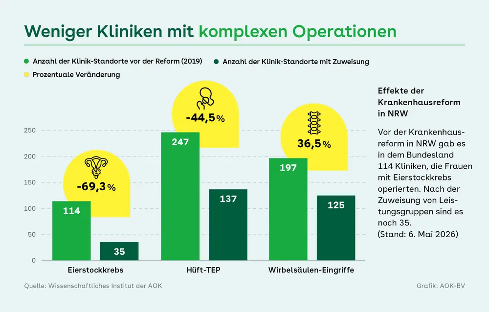Balkendiagramm zu den Folgen der Krankenhausreform in Nordrhein-Westfalen: Die Zahl der Klinikstandorte für komplexe Eingriffe ist deutlich gesunken, bei Eierstockkrebs von 114 auf 35 Standorte (minus 69,3 Prozent), bei Hüft-TEP von 247 auf 137 (minus 44,5 Prozent); bei Wirbelsäulen-Eingriffen von 197 auf 125 (minus 36,5 Prozent). Hintergrund ist die Zuweisung von Leistungsgruppen, die spezialisierte Leistungen auf weniger Kliniken konzentriert.