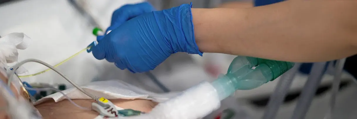 Künztliche Beatmung eines Patienten (AKI) Patient wird liegt im Krankenhausbett und wird künstlich Beatmet. Eine Pflegekraft mit blauen Gummihandschuhen überprüft beim Patienten die Werte.