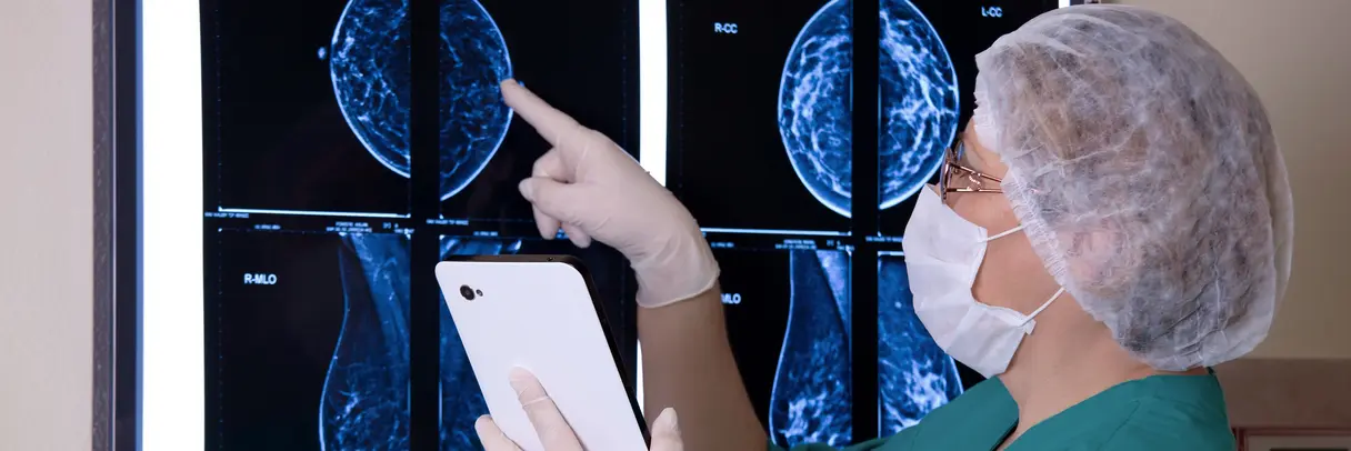 Arzt mit Tablet in der Hand prüft Mammografie-Aufnahmen. Arzt mit Tablet in der Hand prüft Mammografie-Aufnahmen.