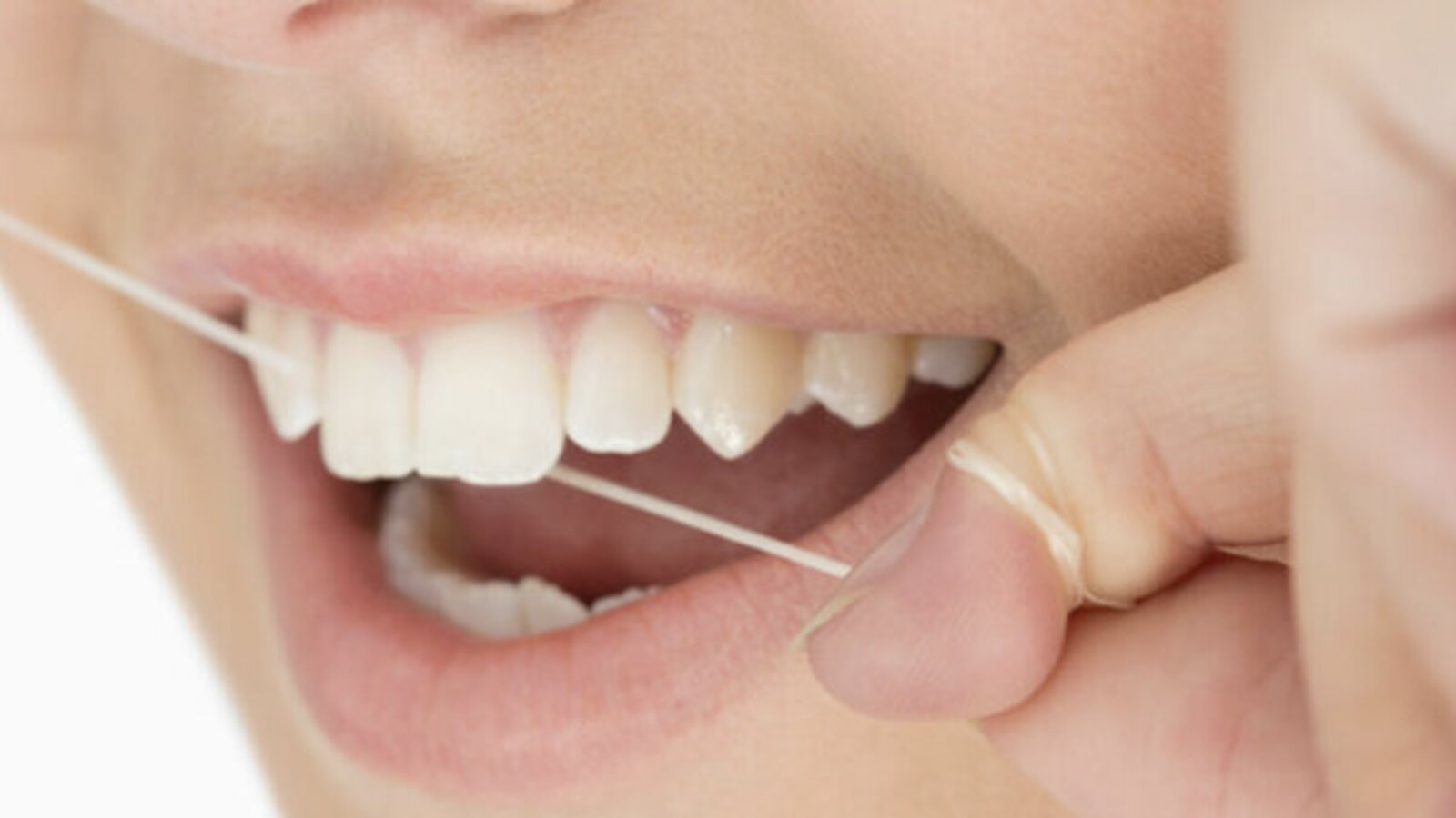 Zahnhygiene ist wichtig, um Karies vorzubeugen. Deshalb empfiehlt die AOK auch mindestens zweimal im Jahr die Zähne professionell reinigen zu lassen.