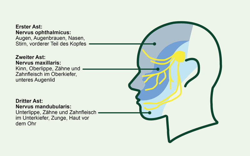 Trigeminusneuralgie: Wie kann man den Schmerz lindern?
