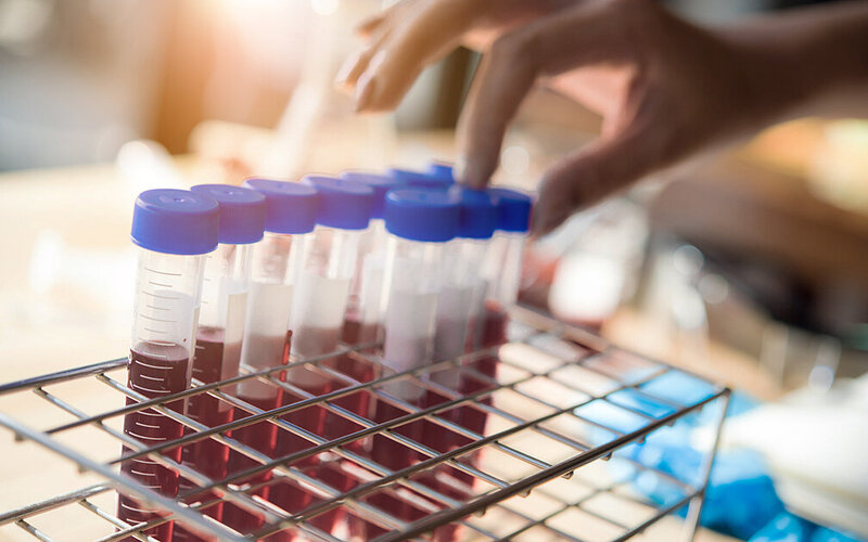 Blutproben werden im Labor untersucht.