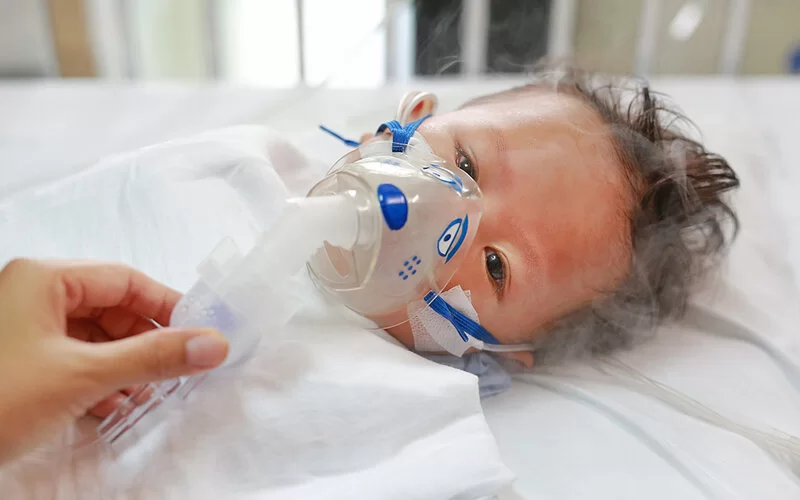 Kleiner Junge mit RSV-Infektion bekommt Inhalationsmedikamente per Inhalationsmaske.