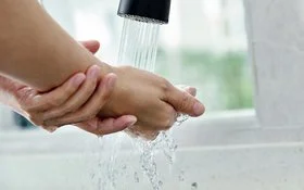 Hand mit leichter Verbrennung wird unter fließendes Wasser gehalten.