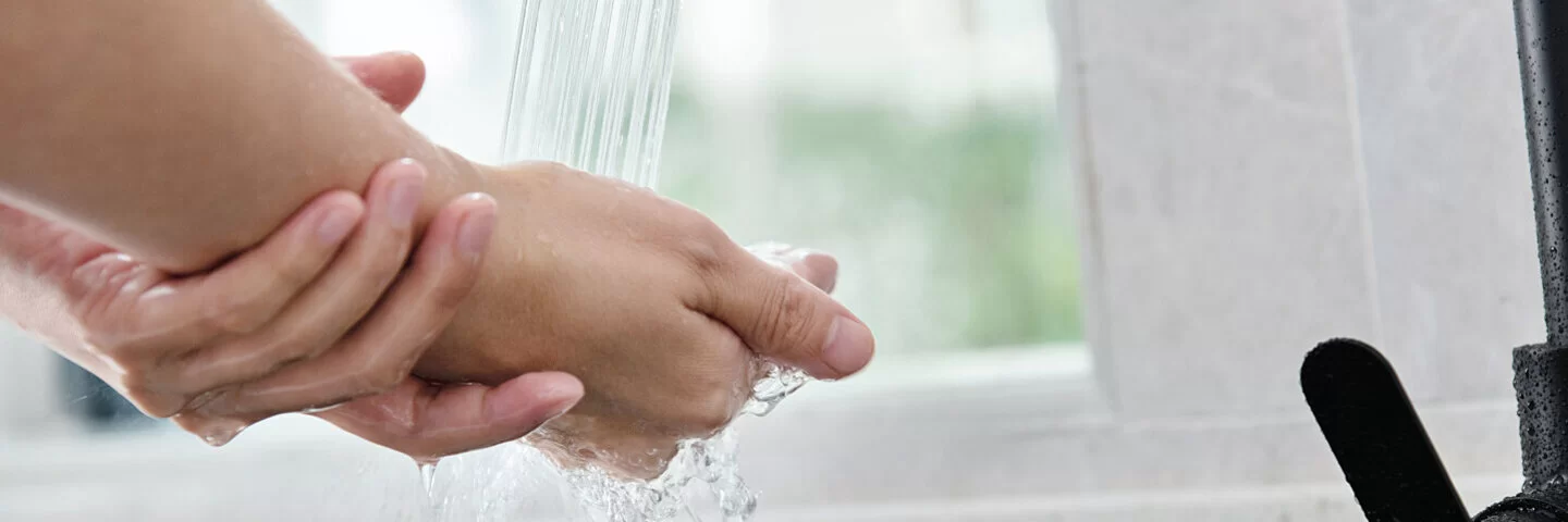 Hand mit leichter Verbrennung wird unter fließendes Wasser gehalten.