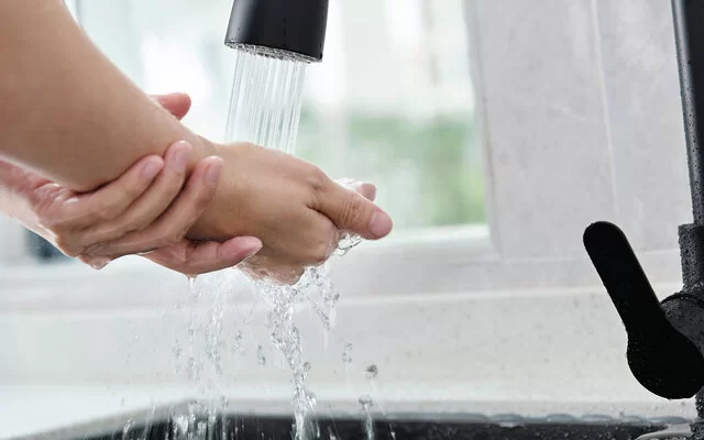 Hand mit leichter Verbrennung wird unter fließendes Wasser gehalten.
