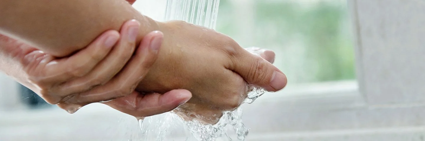 Hand mit leichter Verbrennung wird unter fließendes Wasser gehalten.