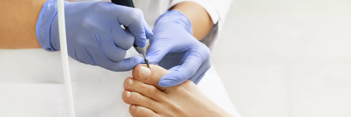 Eine podologische Fachperson bearbeitet die Fußnägel einer Patientin.