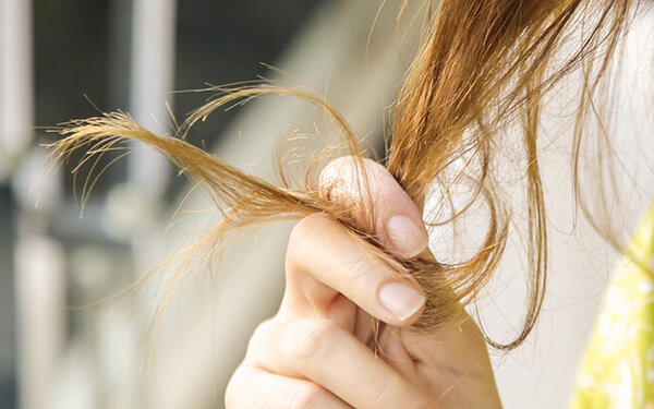Starker Haarausfall sollte vom Arzt abgeklärt werden