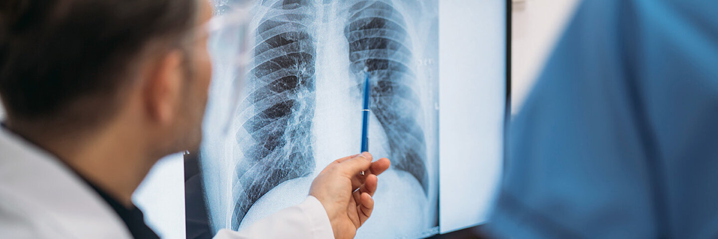 Ein Arzt deutet auf die Röntgenaufnahme einer Lunge. 