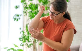 Eine Frau in einer Wohnung mit Grünpflanzen im Hintergrund. Sie blickt auf ihren rechten Ellenbogen und reibt sich die Haut mit einer weißen Creme ein.