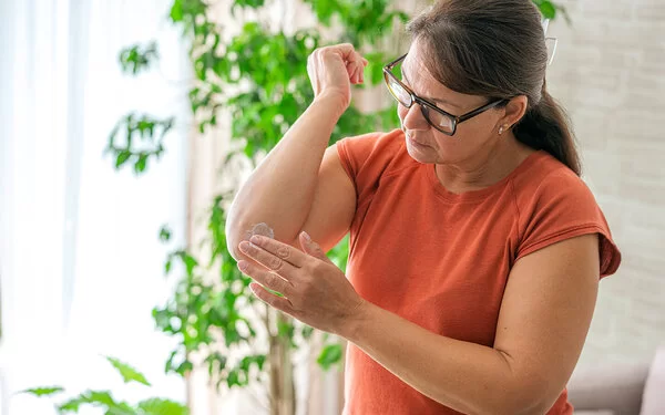 Eine Frau in einer Wohnung mit Grünpflanzen im Hintergrund. Sie blickt auf ihren rechten Ellenbogen und reibt sich die Haut mit einer weißen Creme ein.