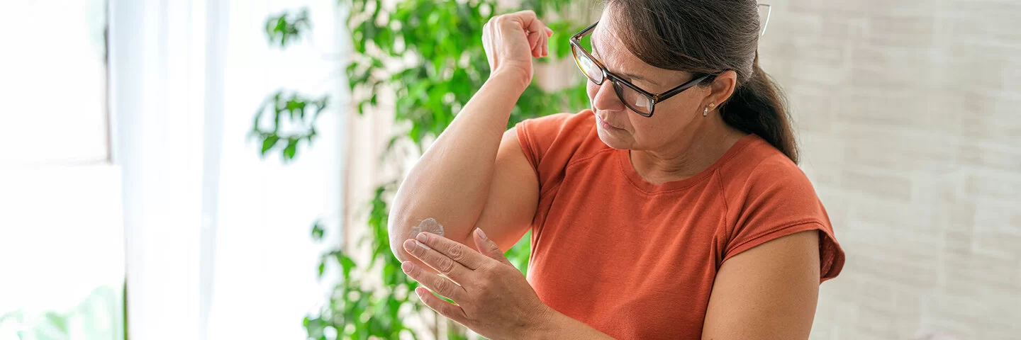 Eine Frau in einer Wohnung mit Grünpflanzen im Hintergrund. Sie blickt auf ihren rechten Ellenbogen und reibt sich die Haut mit einer weißen Creme ein.