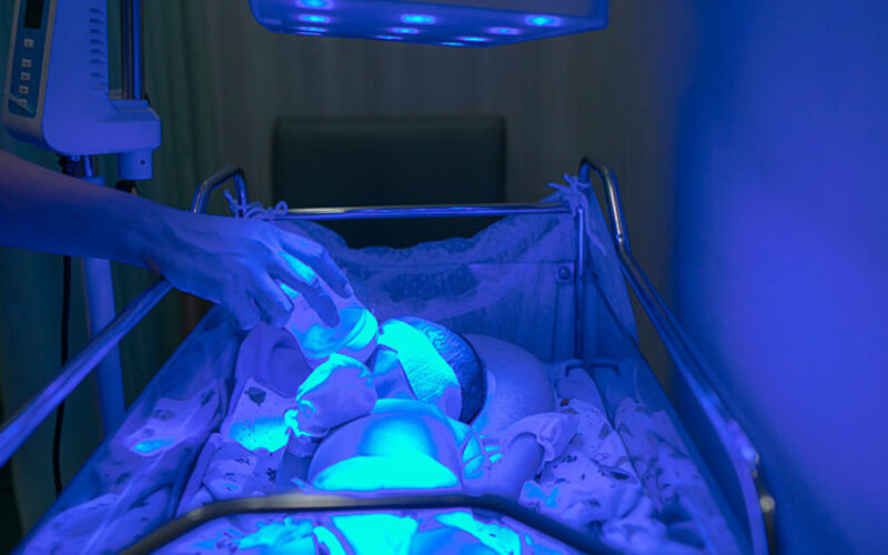 Baby mit Neugeborenengelbsucht wird mittels Lichttherapie behandelt