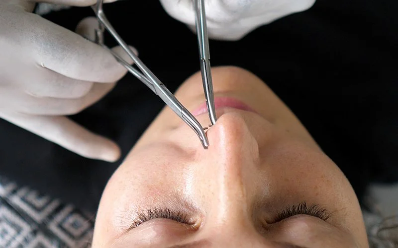 Eine Frau erhält ein Nasenpiercing.