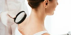 Ein Hautarzt untersucht bei einer Hautkrebs-Vorsorgeuntersuchung die Haut im Nackenbereich einer Patientin mit einer Lupe.