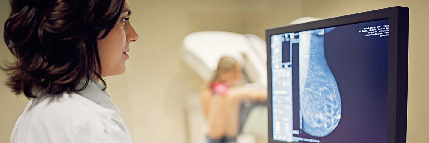 Die Brust einer Frau mit bei einem Mammographie-Screening untersucht. Eine Ärztin überprüft an einem Bildschirm die Aufnahme.