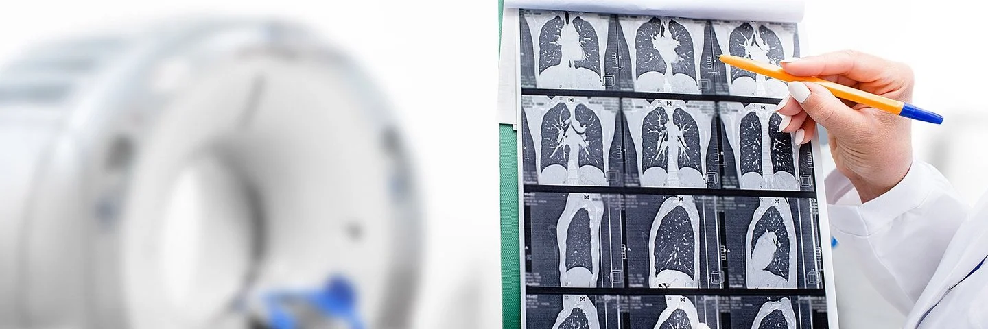 Hände einer Frau in weißem Kittel halten einen CT-Scan der Lunge.