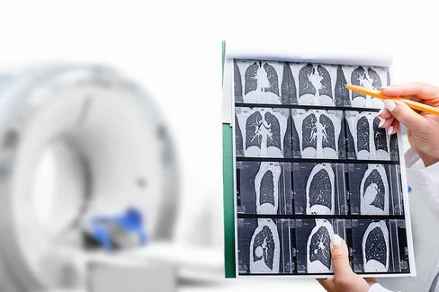 Hände einer Frau in weißem Kittel halten einen CT-Scan der Lunge.