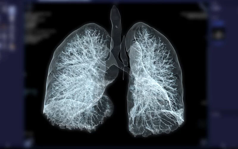 Die Aufnahme einer Computertomografie zeigt das dreidimensionale Abbild einer Lunge.