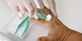 Nahaufnahme. An der braungebrannten Hand eines älteren Menschen wird eine Wunde zwischen Zeige- und Mittelfinger versorgt. Hände in klinischen Gummihandschuhen pressen mit einer grünen Pinzette einen Wattebausch auf die Wunde.