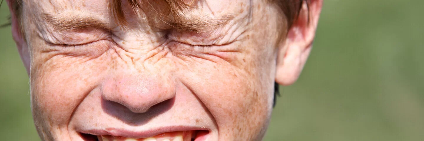 Rothaariger Junge mit Tourette-Syndrom blinzelt und lacht mit breitem Grinsen in die Sonne.