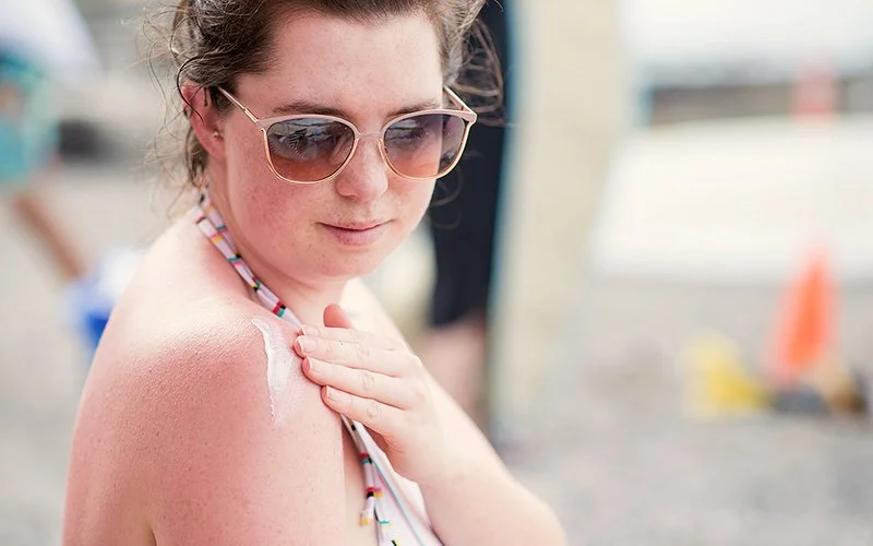 Eine junge Frau cremt sich mit Sonnencreme ein, um einen Sonnenbrand zu verhindern.