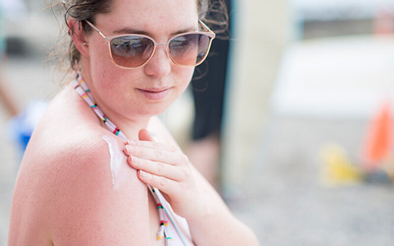 Eine junge Frau cremt sich mit Sonnencreme ein, um einen Sonnenbrand zu verhindern.