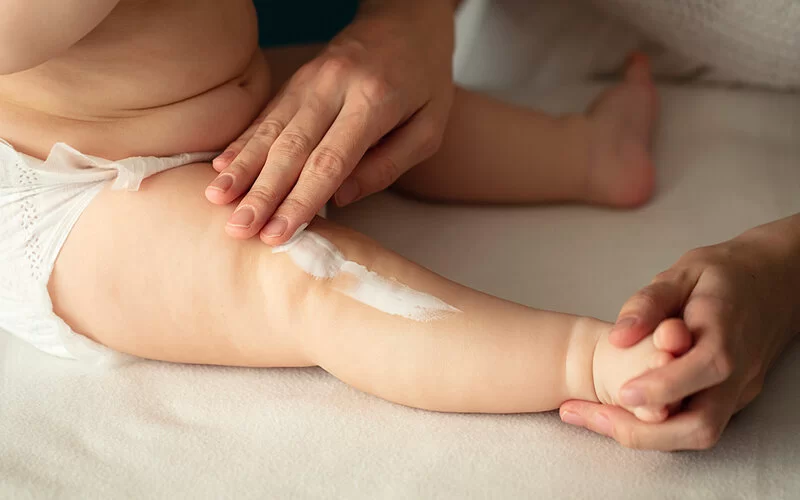 Ein Baby wird am Oberschenkel von der Mutter mit Salbe eingecremt.