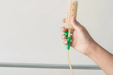 Nahaufnahme eines Applikators einer Ernährungssonde. Der Applikator ist mit einer Ernährungskost gefüllt. Am Applikator ist die Hand einer Pflegefachkraft zu sehen.