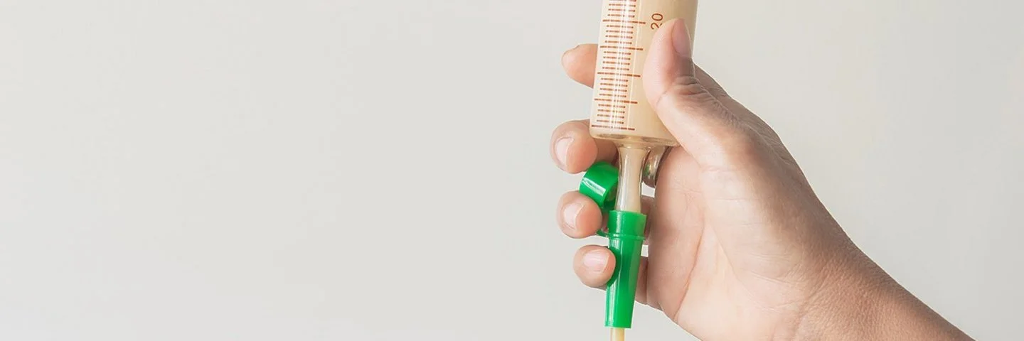 Nahaufnahme eines Applikators einer Ernährungssonde. Der Applikator ist mit einer Ernährungskost gefüllt. Am Applikator ist die Hand einer Pflegefachkraft zu sehen.