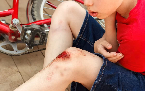 Junge im roten T-Shirt blickt auf sein aufgeschürftes, blutendes Knie. Neben ihm ein umgestürztes Fahrrad.