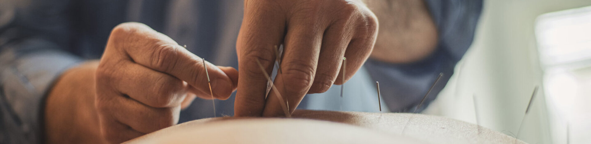 Ein Therapeut setzt Nadeln am Rücken eines Patienten. Bei einigen Erkrankungen kann Akupunktur als Ergänzung zur Schulmedizin eingesetzt werden.