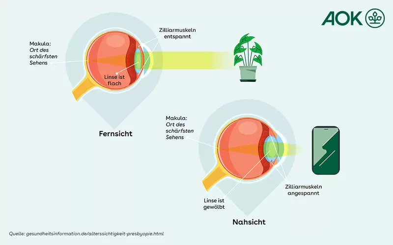 Grafik zeigt den Aufbau des Auges bei Nah- und Fernsicht.