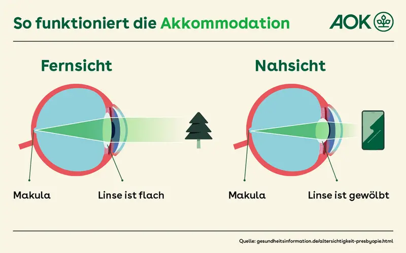 Grafik zeigt den Aufbau des Auges bei Nah- und Fernsicht.