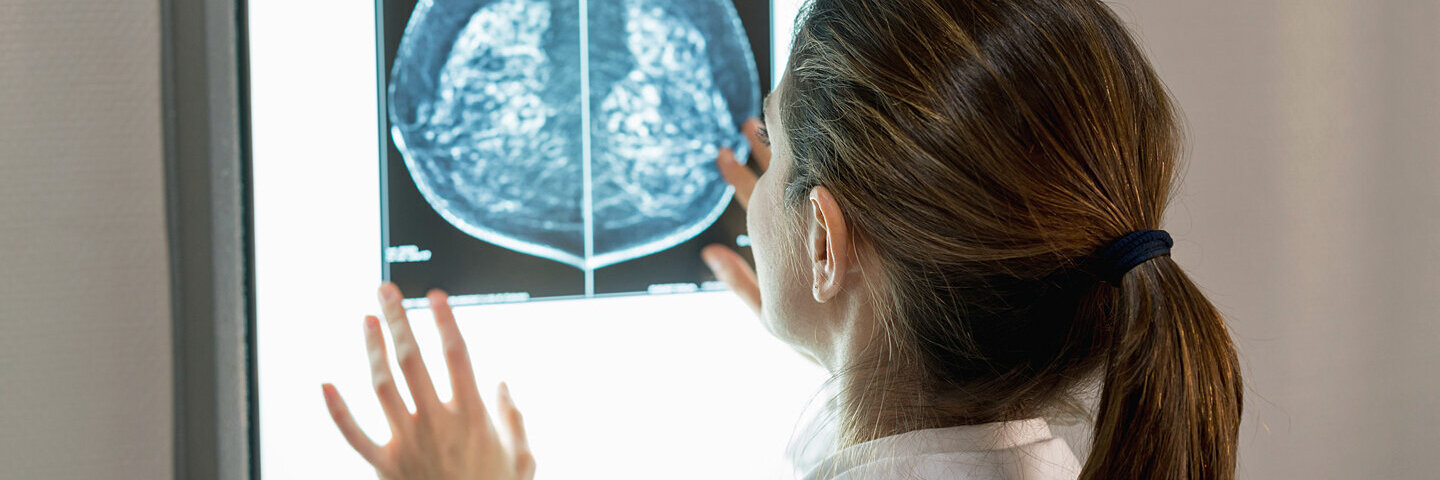 Eine Ärztin schaut auf die Aufnahmen eines Mammographie-Sreenings.