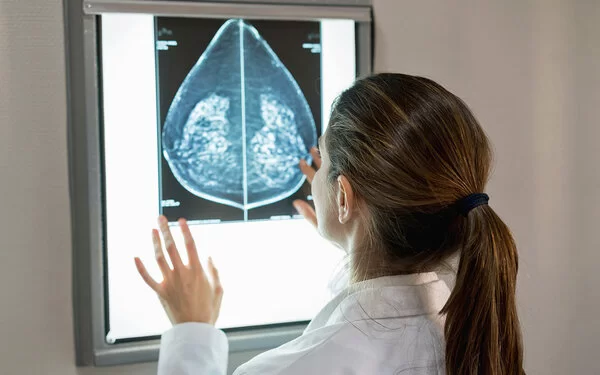 Eine Ärztin schaut auf die Aufnahmen eines Mammographie-Sreenings.
