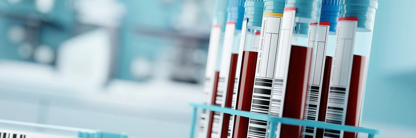 Röhrchen mit Blutproben befinden sich in einem Ständer in einem Labor.