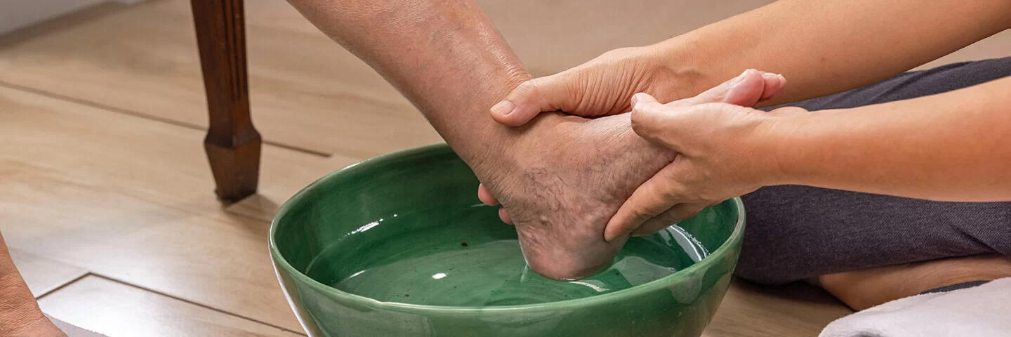 Eine Pflegekraft macht einer Patientin mit diabetischem Fuß ein Fußbad.