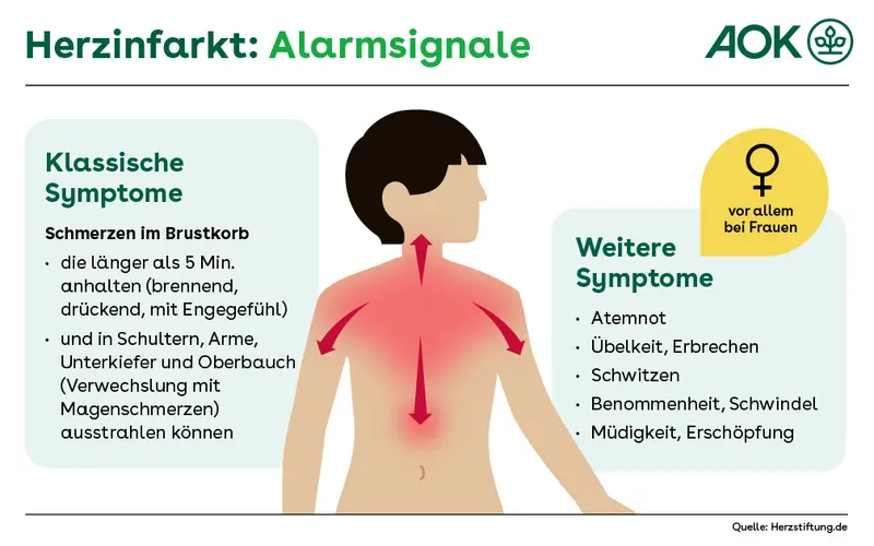 Die Grafik zeigt einen stilisierten Menschen. Auf dem Körper sind die Partien rot markiert, an denen bei einem Herzinfarkt Schmerzen auftreten. Zusätzlich erläutert der Text klassische Symptome sowie spezifische, die vor allem bei Frauen auftreten.