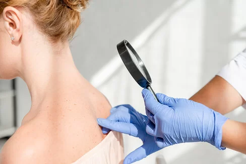 Dermatologe untersucht mit einer Lupe die Haut einer Patientin.