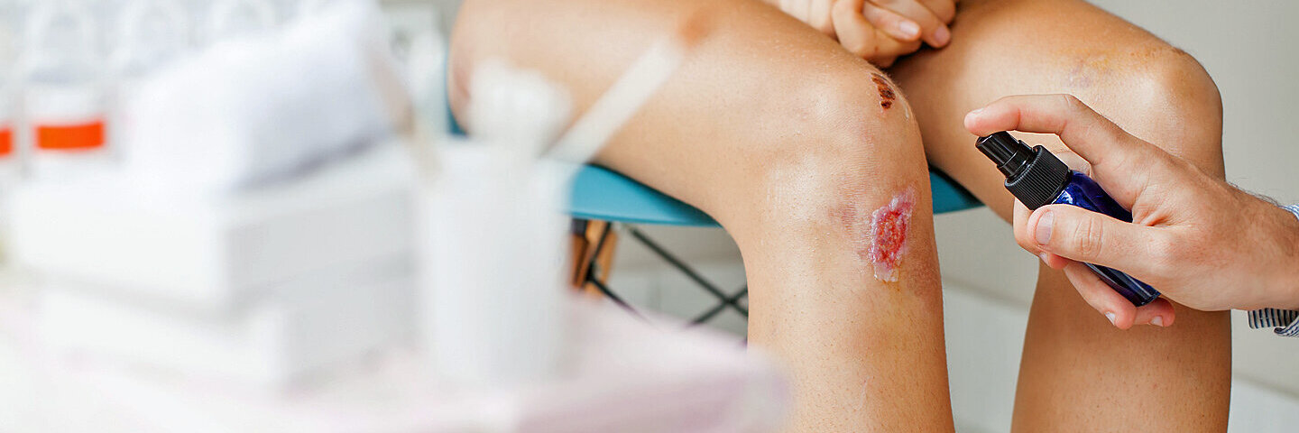 Eine Person lässt ihr verletztes Knie desinfizieren und verarzten.